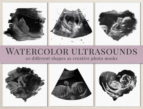 ultrasound photomasks